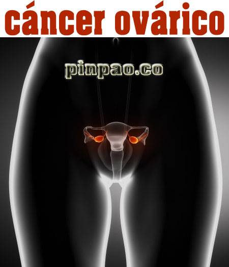 cancer-ovarico