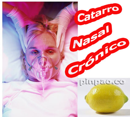 catarro nasal