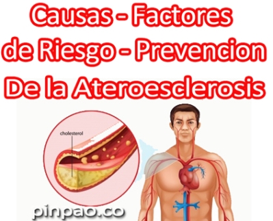 causas de la ateroesclerosis