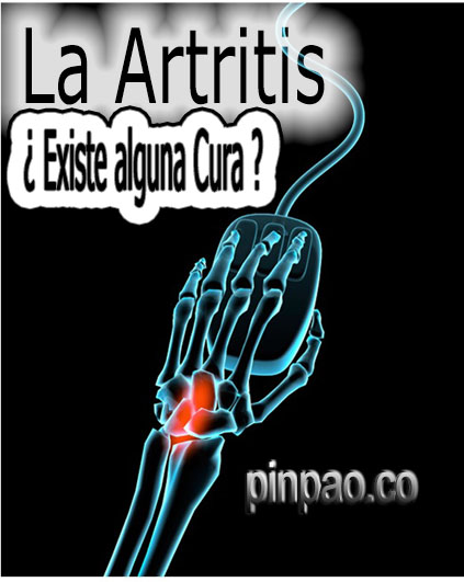 la-artritis